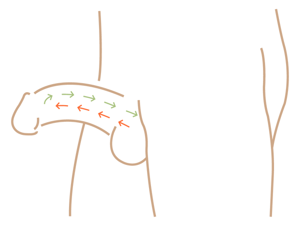 Blood leaving the penis