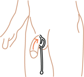 Loop stretched up and around the scrotum