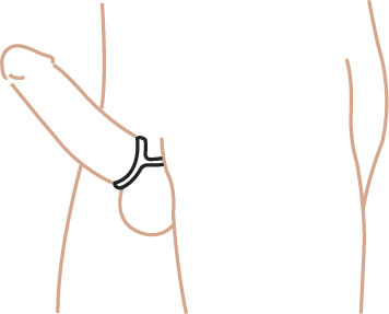 Ring at the base of the penis, loop hanging in front